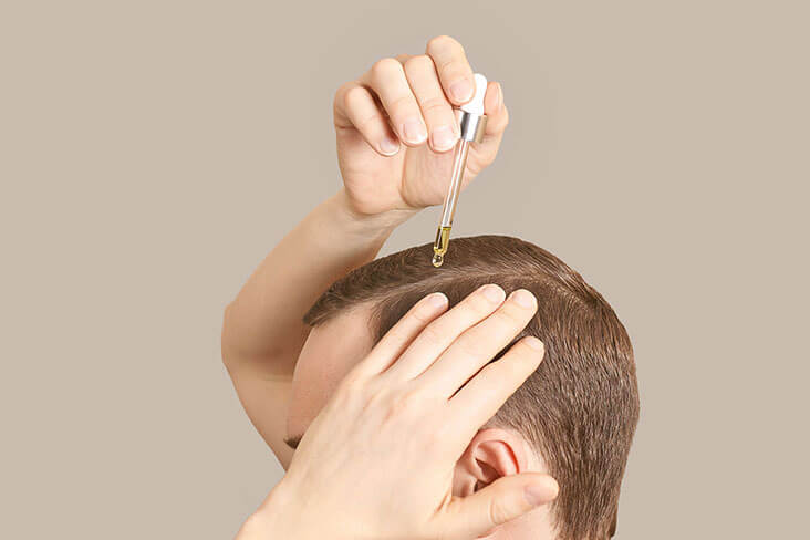 A man applying a dropper full of solution onto his head