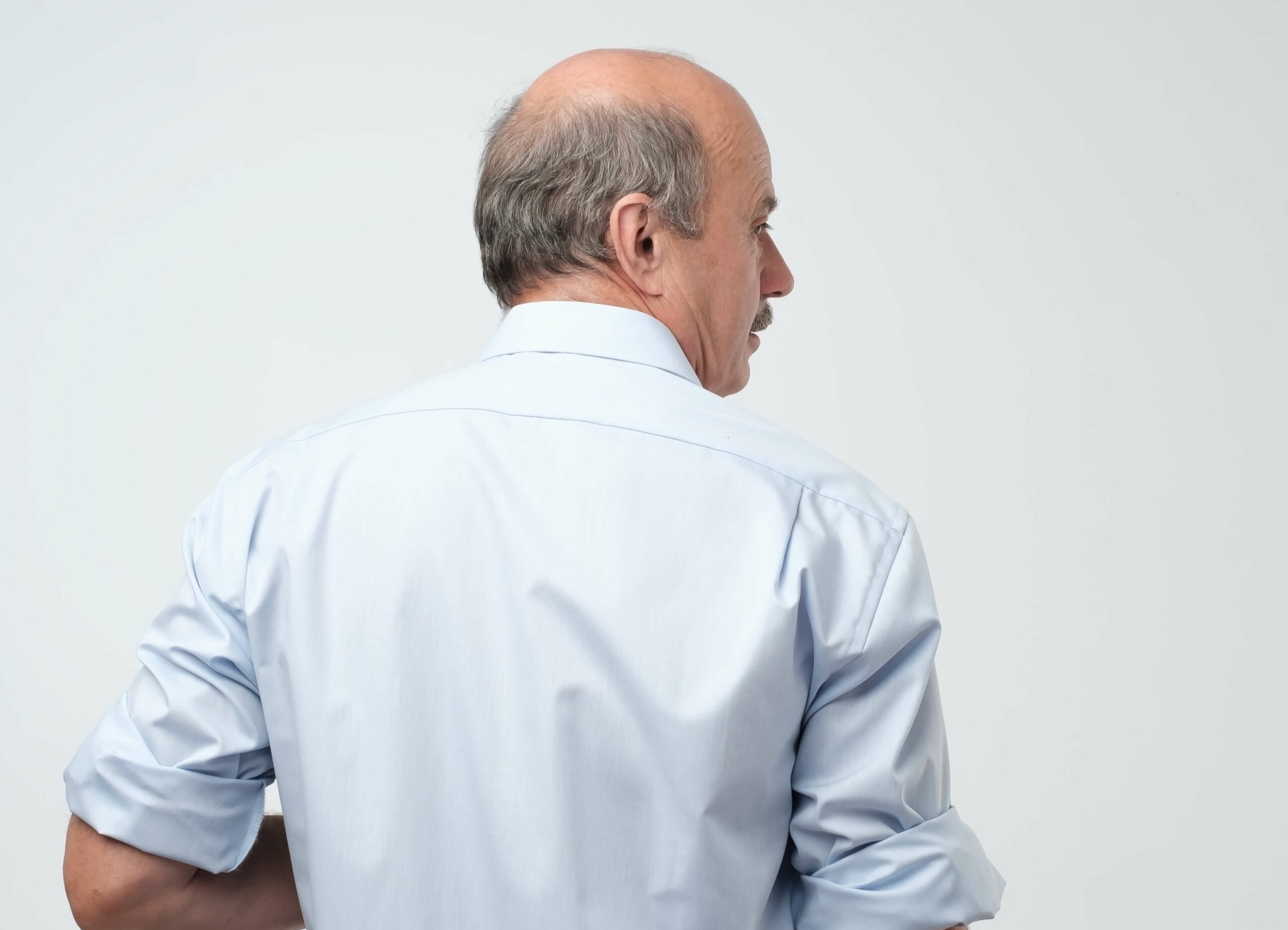 The back of a bald man with his head turned to the right, showing the areas of the scalp that androgenic alopecia affects.