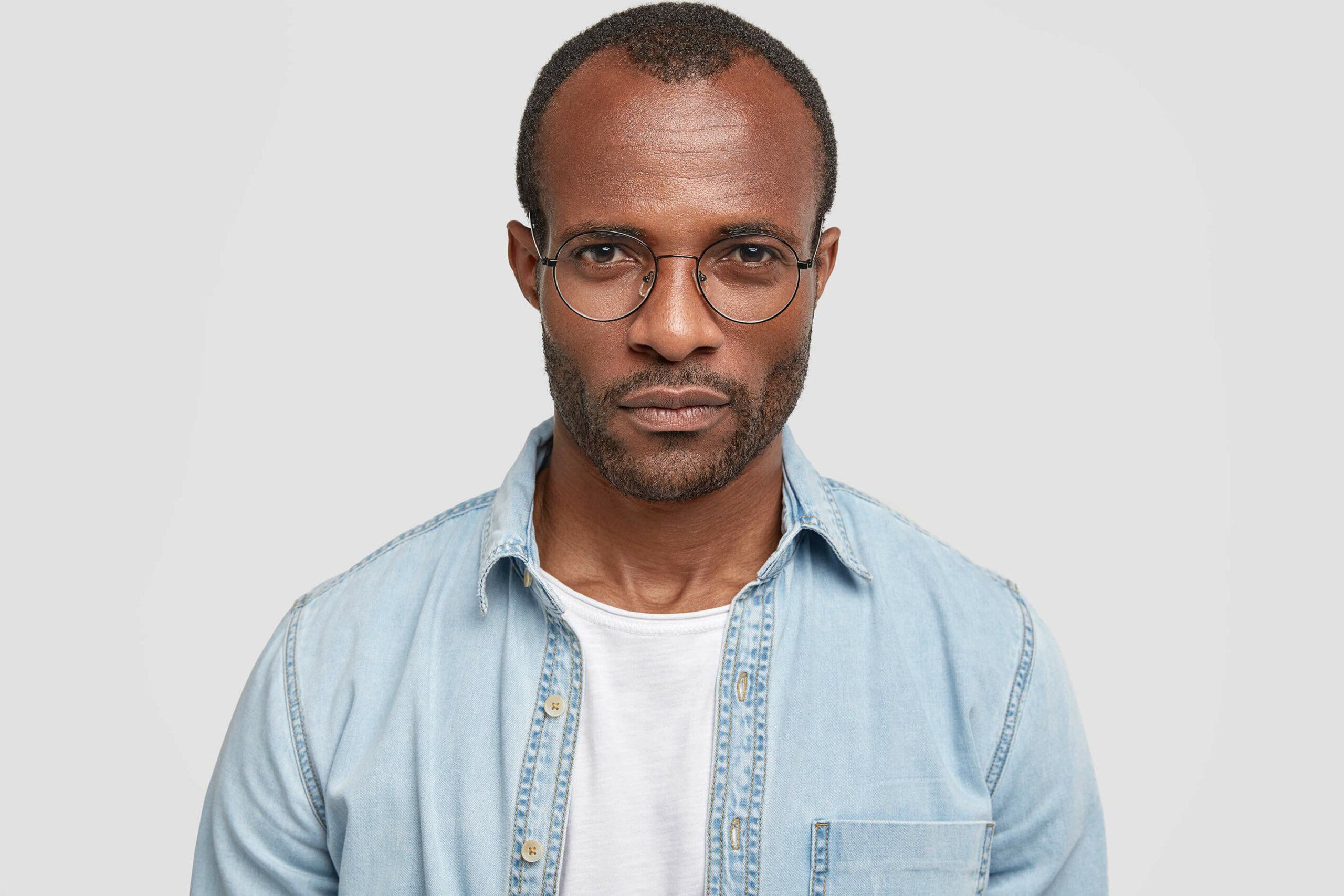 An African American man with the distinct 'M' shape caused by temple hair loss 