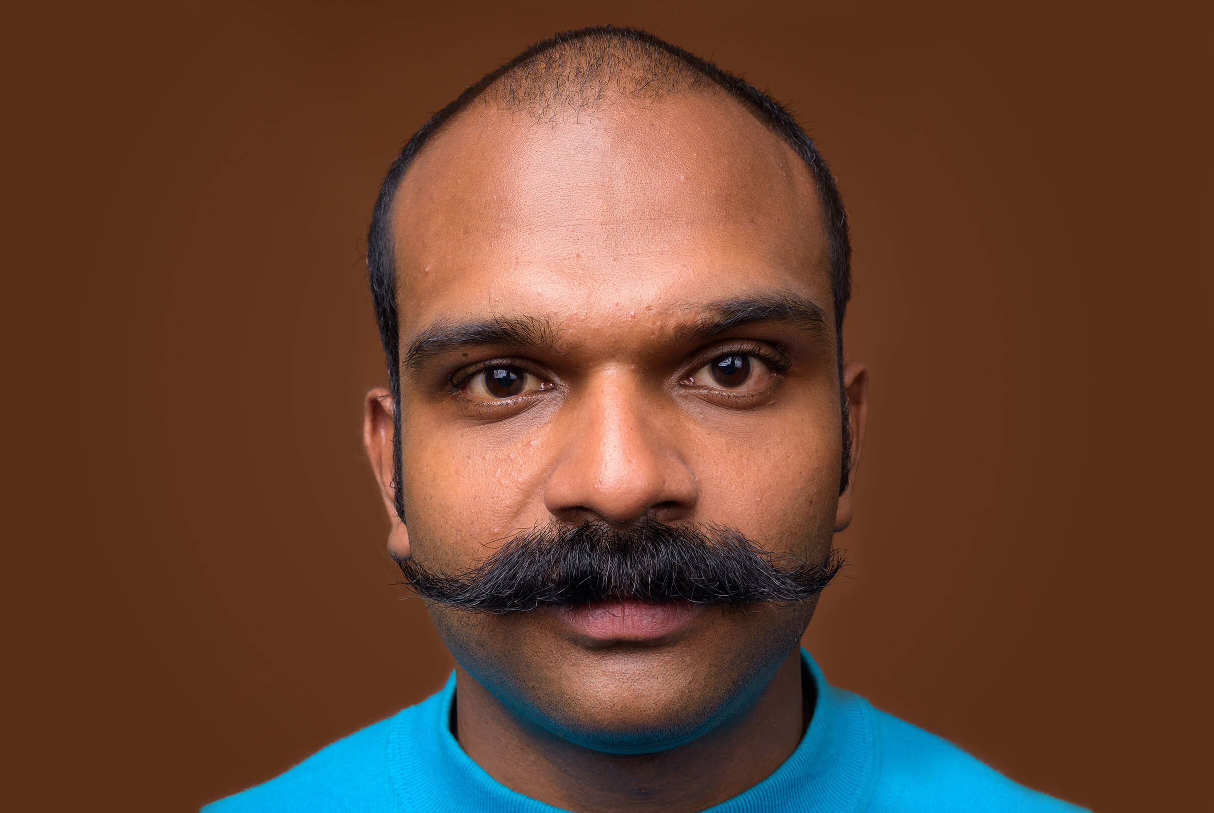 A headshot of a South Asian man with a handlebar style mustache and androgenic alopecia affecting his entire hairline