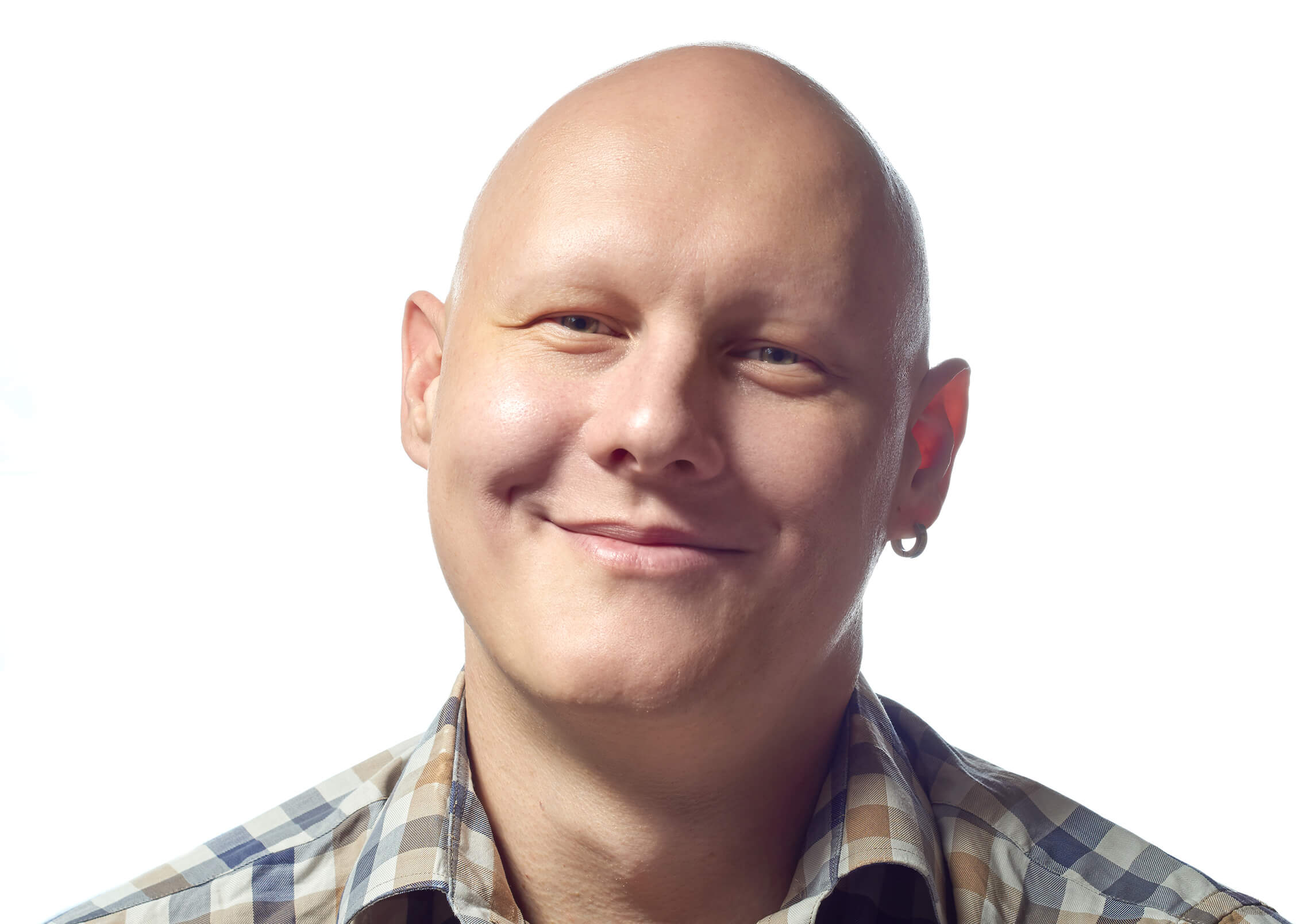 A headshot of a man with alopecia universalis